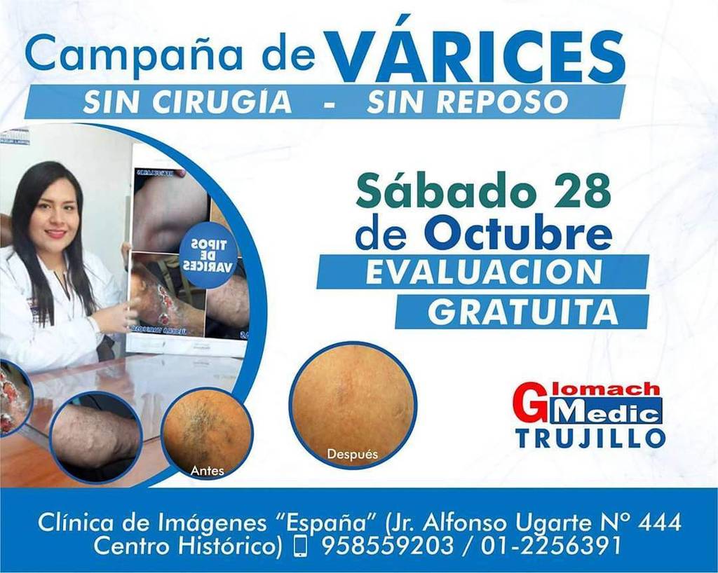 VaricesGlomach's tweet photo. #campañasdesalud #NoVarices #Trujillo
Los esperamos este sábado 28.
Gracias.#campañasdesalud #NoVarices #Trujillo
Los esperamos este sába… https://t.co/nG8vZOZcgv