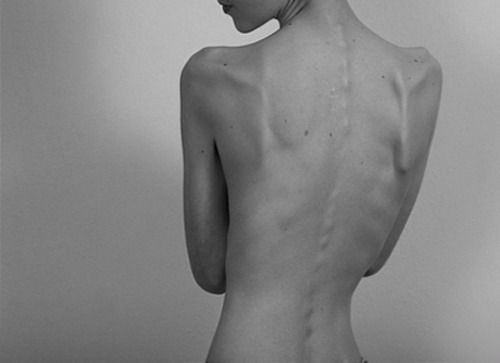 fxtcals's tweet photo. i WILL look like this

#thinspo #bonespo #ednos https://t.co/9NBa5iH4Z8