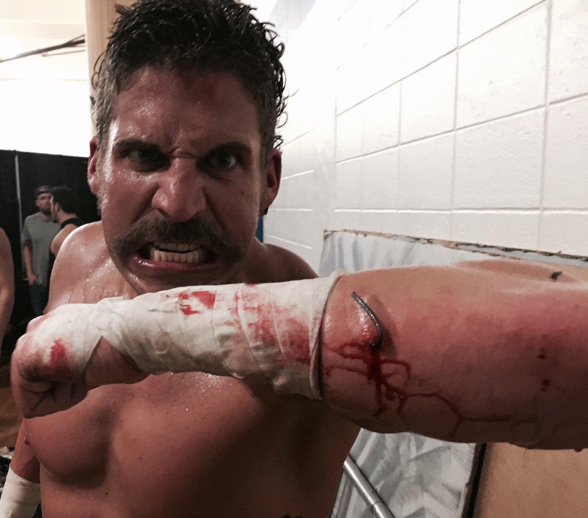 ChaoticWrestlin's tweet photo. Hate him or love him, @chasedelmonte showed major guts inside #CagedChaos, and has the battle scars to prove it 

#CWBreakingPoint https://t.co/53eISmMkWn