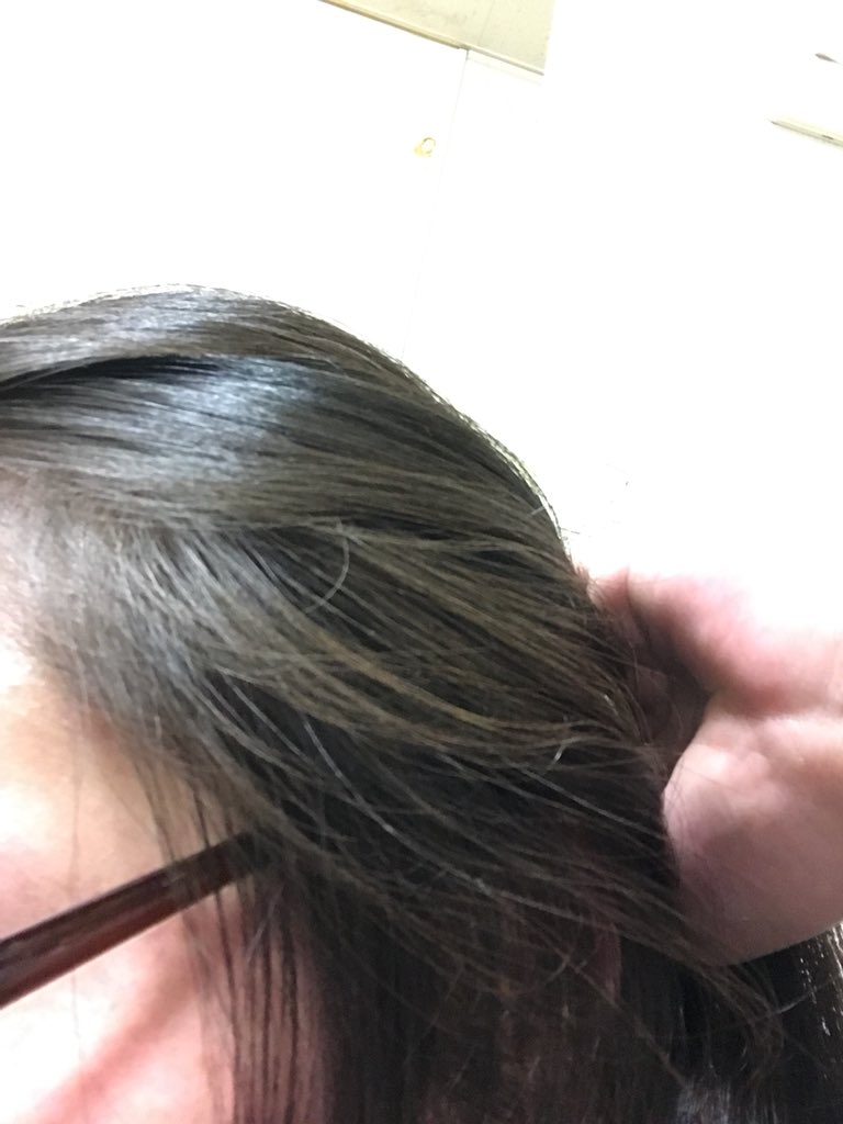 きつね嫁 Auf Twitter 私もそれで高校の時に染めさせられた それで髪の毛傷んで再度染め直し 物凄く悪循環 アッシュっぽい色してるけど染めてない これが地毛なんです W 白髪は無し 太陽光の下ではもっと明るいです 小さい時はもっと茶髪だった きつね嫁 Auf Twitter 私もそれで高校の時に染めさせられた それで髪の毛傷んで再度染め直し 物凄く悪循環 アッシュっぽい色してるけど染めてない これが地毛なんです W 白髪は無し 太陽光の下ではもっと明るいです 小さい時はもっと茶髪だった