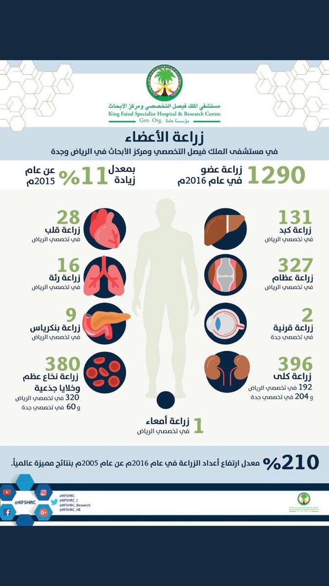 معلومات عن زراعة الأعضاء