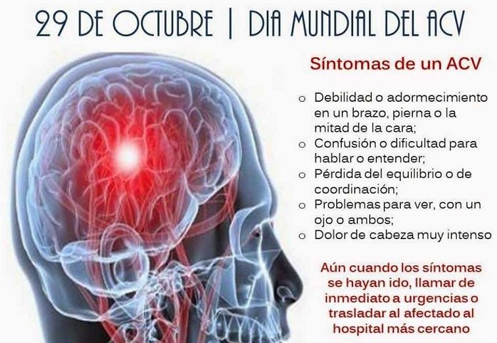 DocSergioZeta's tweet photo. #Efemerides #UnDiaComoHoy #29Oct
#DiaMundialDelACV #WorlStrokeDay #AtaqueCerebral #Stroke #Ictus
#Argentina tiene c/4 min un #ACV  Lee: ⬇️ https://t.co/psmsB13xzo