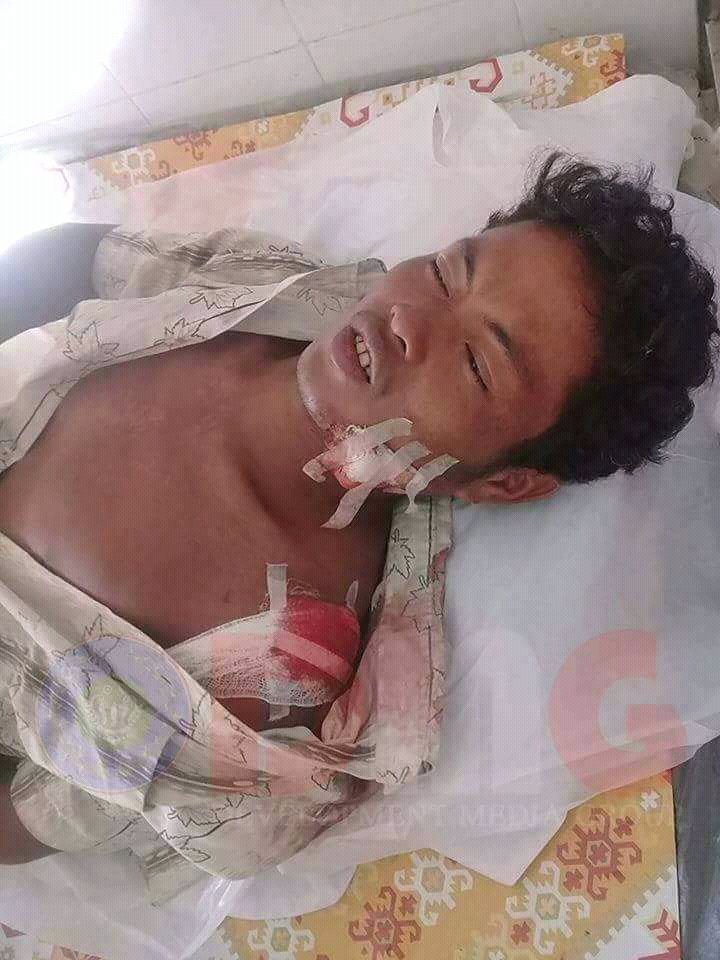 eithetthetaung3's tweet photo. @mccann_liz @nslwin @AssedBaig No,they are killers.They killed Rakhine and Hindu people,you know? https://t.co/4Gkx7Qi0kE