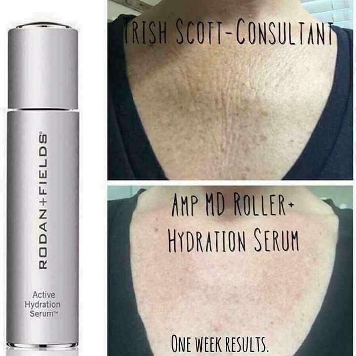 learnaboutskin's tweet photo. What does your skin want that it is not getting enoughof?  https://t.co/BYBEKDaVGI  #skincare #hydrating #moisturizer #loveyourself #wrinkle https://t.co/8jbmmoE9YJ