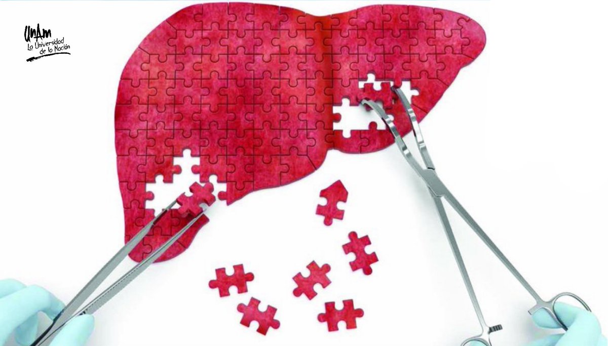 UNAM_MX's tweet photo. Ingesta excesiva de alcohol, obesidad y hepatitis pueden provocar fibrosis hepática. Conoce más con #CienciaUNAM >  https://t.co/pIX9121jiE https://t.co/3khOF50B0I
