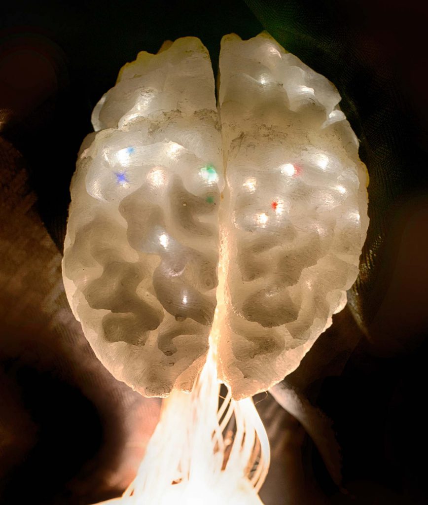 ofs_telecom's tweet photo. Optical Fibers Illuminate Brain Activity #brain #education https://t.co/3IHWVfphue https://t.co/Pfx0LgCCMf