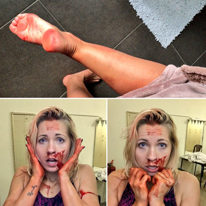 Blood all over us - #custom #gg #girlgirl #catfight #fight #bite #order #bleeding #halloween #destroyed