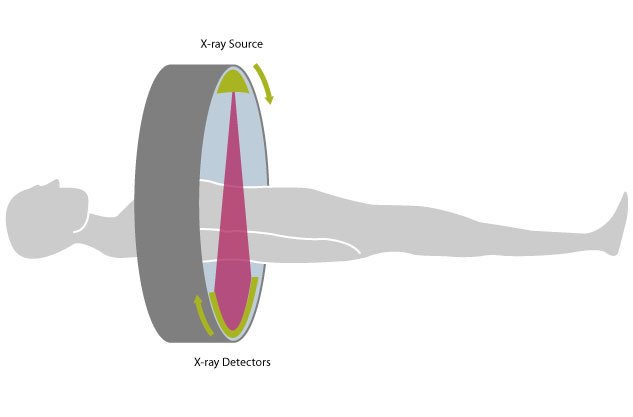 ATLAS OF ENTEROSCOPY