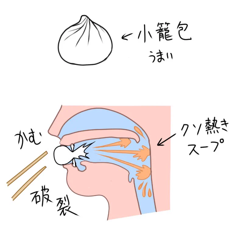小籠包あるある？噛んだ瞬間のクソ熱スープの悲劇…！