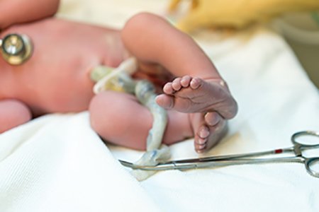 AAPNews's tweet photo. Updated @AmerAcadPeds policy reaffirms value of public over private cord blood banks. https://t.co/DhOcvYOg9P https://t.co/iWtHhpKy4B