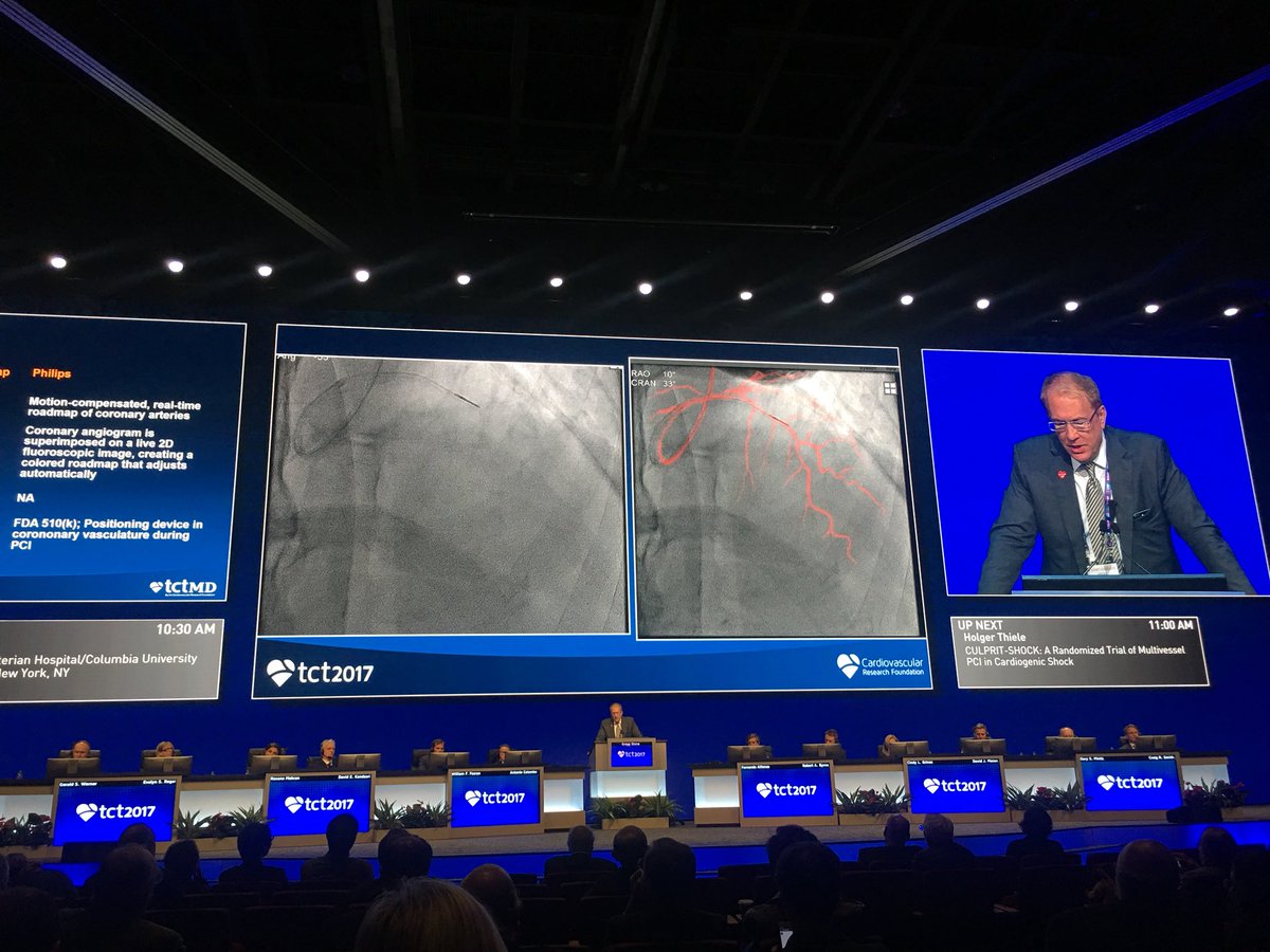 SukhNijjer's tweet photo. New York Presb @nyphospital team lead by @ajaykirtane demonstrating @PhilipsHealth Dynamic Coronary Roadmap #gettingthissoon #TCTDenver https://t.co/Xyazm9AZYK