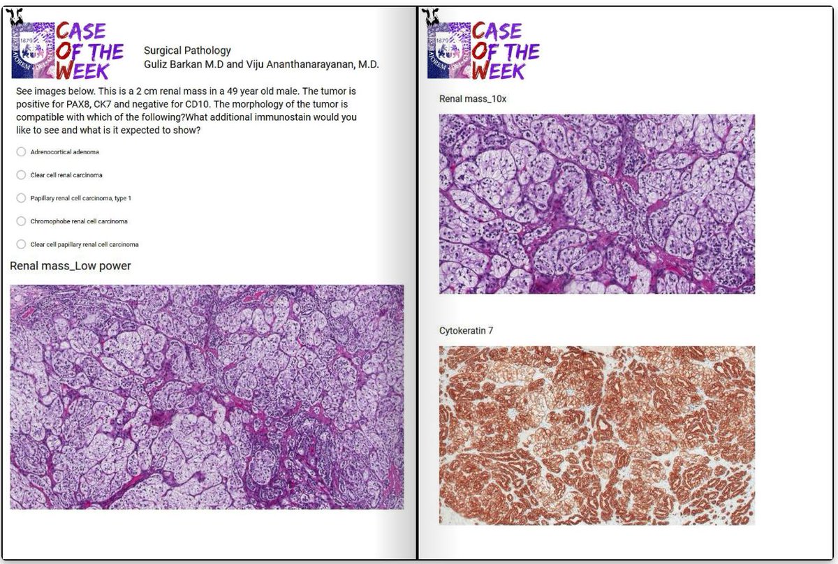 loyolapathology's tweet photo. @loyolapathology Pathology Case of the Week (C.O.W.) #pathology https://t.co/aihhhSjxxj