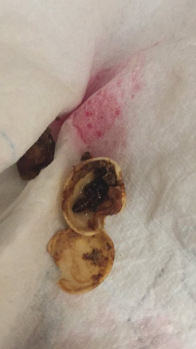 AlphaG33k's tweet photo. @AsdaServiceTeam my pregnant Fiancée reported this hours ago and has had no reply. Reporting you to health standards. Disgusting. https://t.co/kdb1AfKJi9