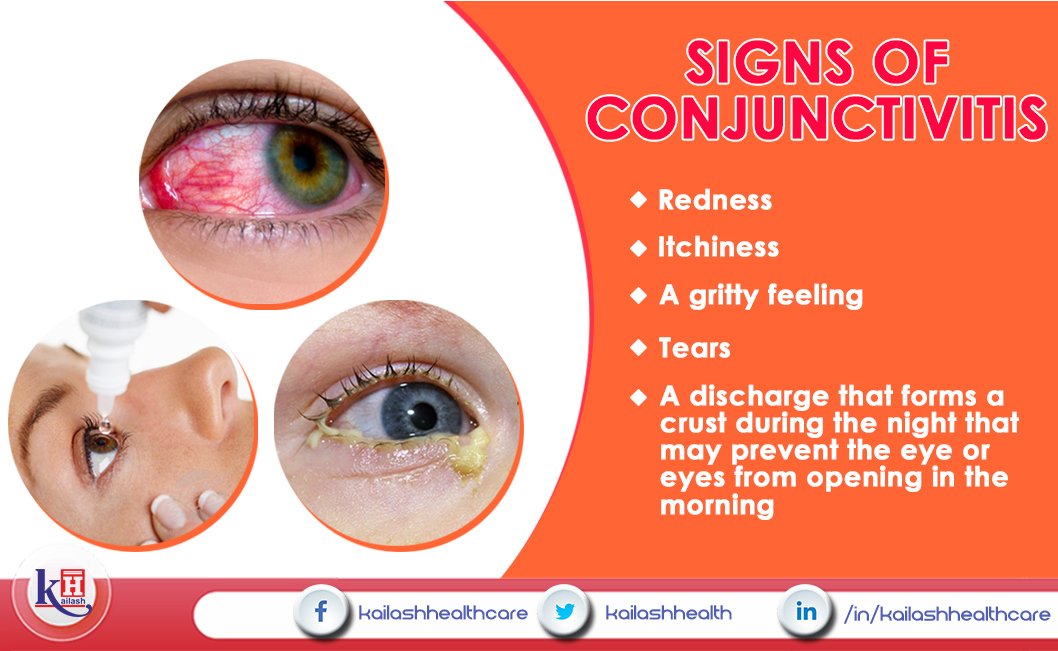 Eye Crust In The Morning