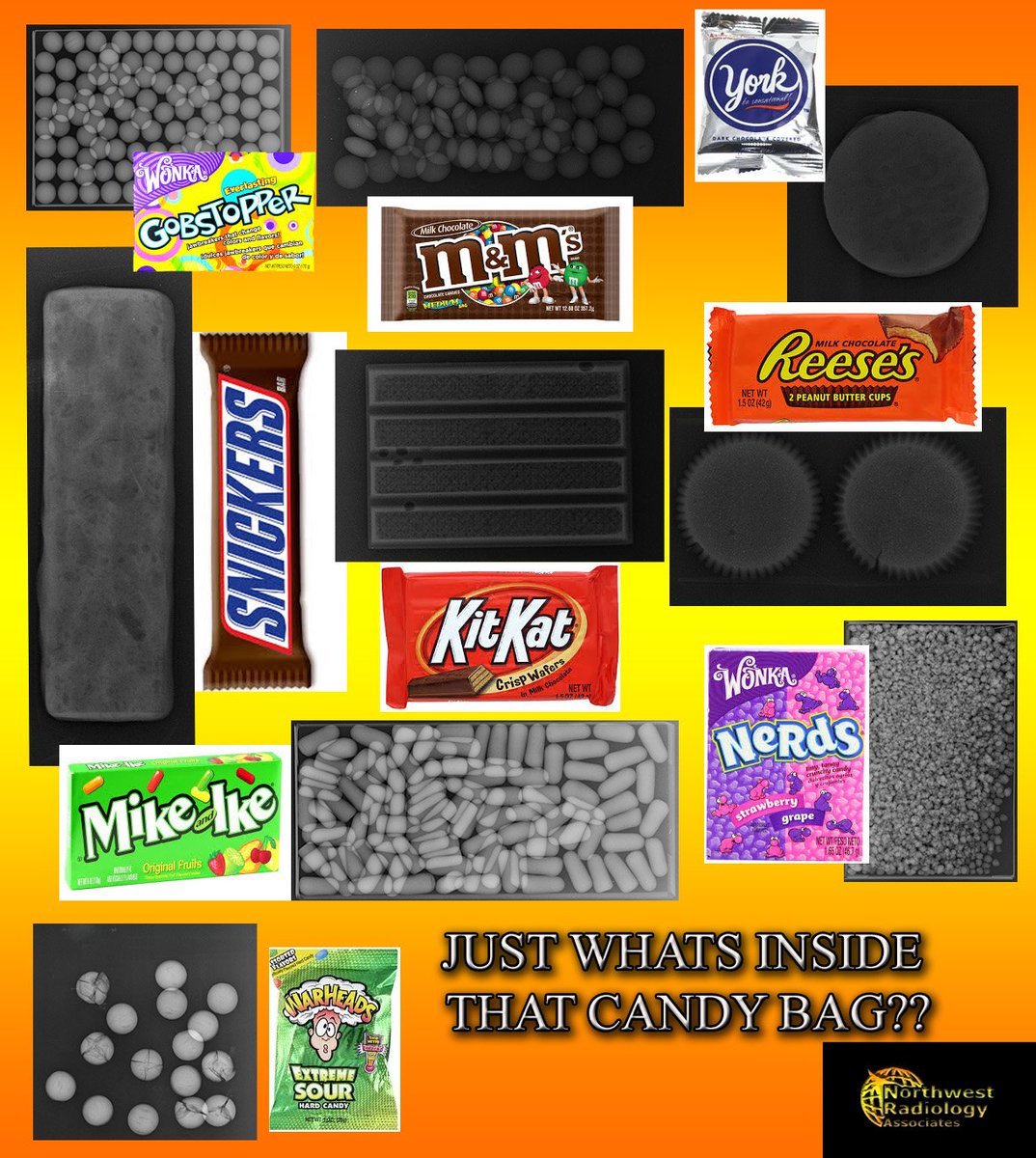 Happy Halloween #Candy #Radiology #Halloween #Xray