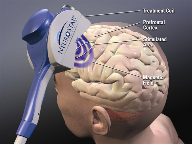 RevUpBilling's tweet photo. Experienced medical billing services for TMS therapy. #behavioralhealthrcm #Ohiomed
https://t.co/cOSMzYsYYv https://t.co/NNcqRRc8zE