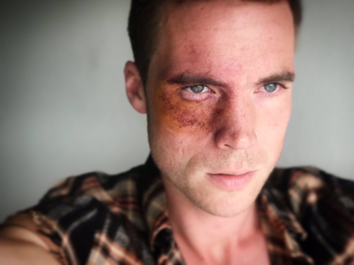 SibsWebSeries's tweet photo. What happens when you steal your sisters #halloween candy. #sibs @Bryanscamman vs @Kimberlyniccol #halloween2017 👻 https://t.co/Ny3am7A2In