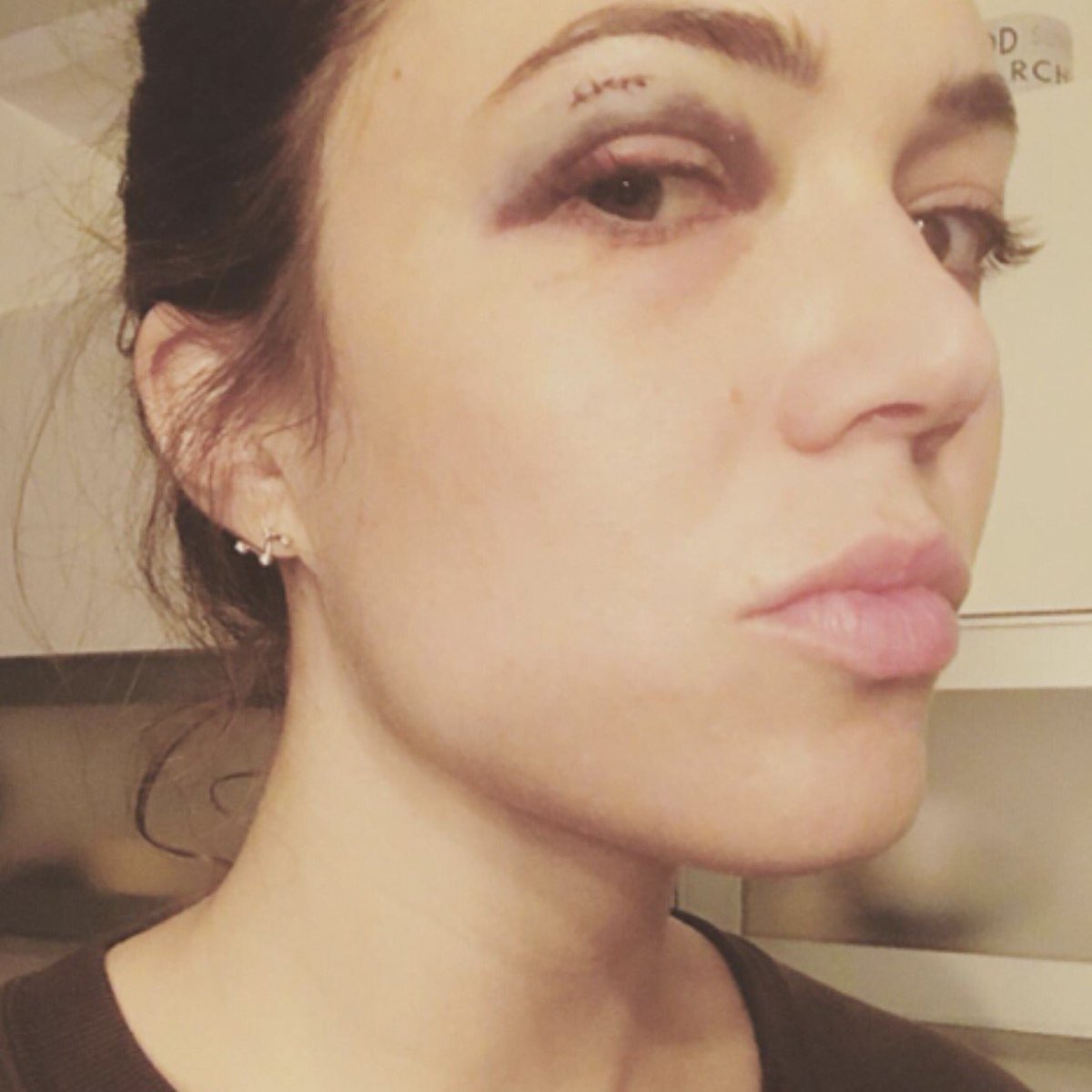 ThisIsUsFanCrew's tweet photo. So...not so fun fact...Mandy's eye was bruised while filming tonight's episode, but @MakeupZoe came through! #MakeUpMiracle *IG takeover MM https://t.co/DvBH1Reozf