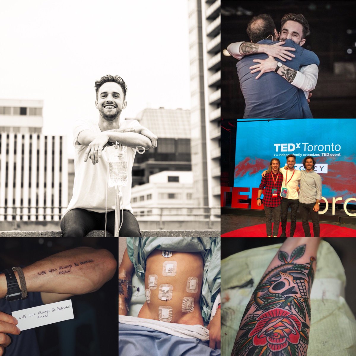 JeremieSaunders's tweet photo. To the last day of the craziest month of my life. Surgery, @sickboypodcast doc, tattoos, @TEDxToronto, blood, sweat and tears for years. ❤️ https://t.co/TeRFwhixRE