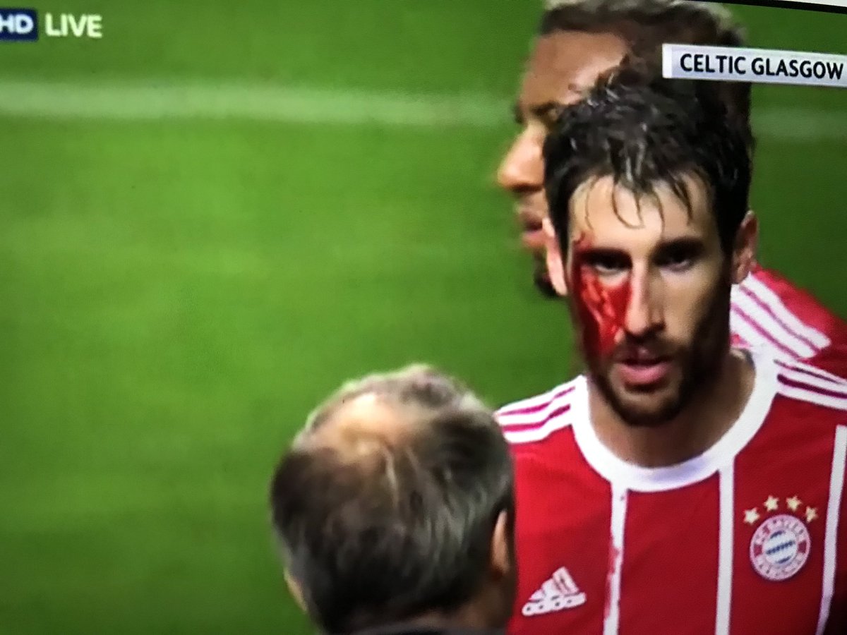 #Halloween in Glasgow! #martinez #CELBAY