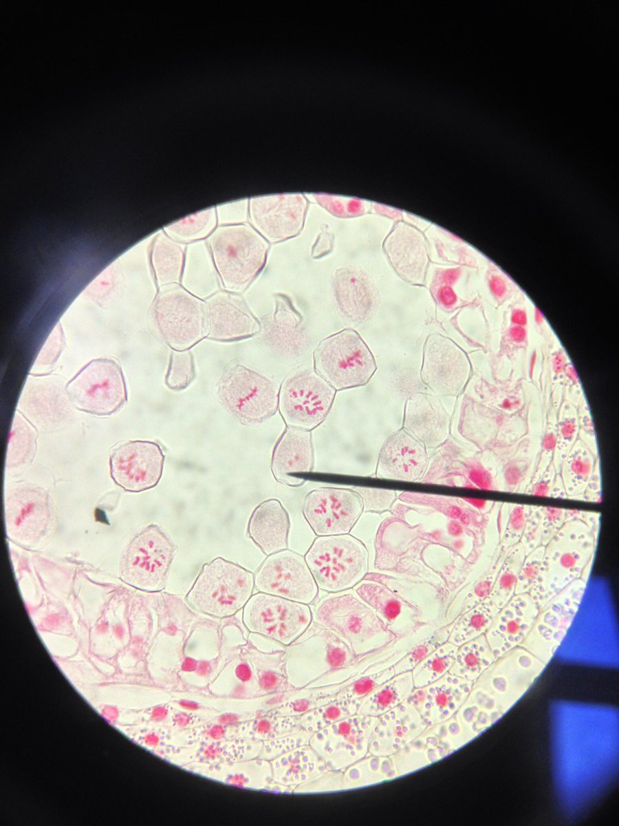 j11p43f's tweet photo. Meiosis in lily anthers; the prophase pairing of homologous chromosomes and metaphase spindle formation, lit up in pink!
#MicroscopeScience #PlantsAreCool #BiologyIsAwesome https://t.co/IAcMLOCcZd