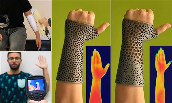 3dersorg's tweet photo. Researchers develop 3D printed orthopaedic casts with improved thermal comfort
https://t.co/Dnjl6E5Nb6 @tudelft #3dprinting https://t.co/VABGzdrWh0