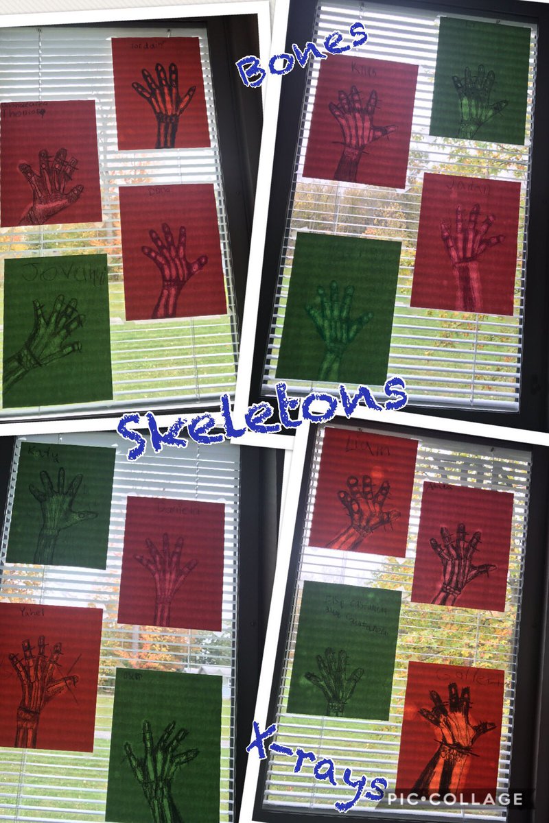 MrD_Chestnut3's tweet photo. We learned the importance of our bones and made X-rays of our hand! They turned out really cool! ππΌπ #wehave27bonesinourhand! #ChestnutPRIDE https://t.co/N4iewt2UWR