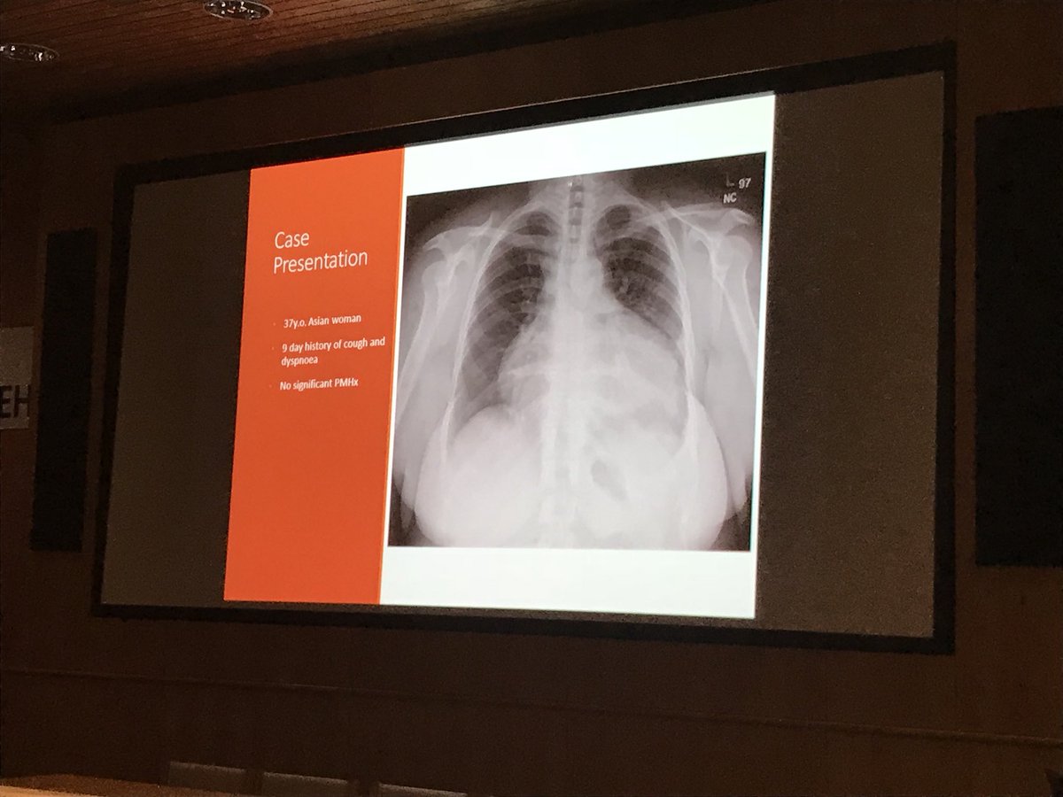 emuss_uk's tweet photo. Abstract 3, Tamponade on #POCUS #emussconf3 #rcemlearning #GEHealthcare @drshahrul80 @jrobi09 @lauraellen115 @esemultrasound @EmergOmBur @rgonzalezo82 @iceman_ex @RBuhumaid @sasem_2017 @EDE_blog @jiconnoly https://t.co/oH9GYC3zKR
