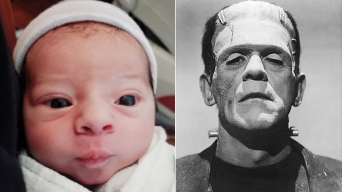 No tricks, a baby #Frankenstein was born in Florida on #Halloween bit.ly/2h0WxUx?utm_so… https://t.co/s9qUAHgpVP