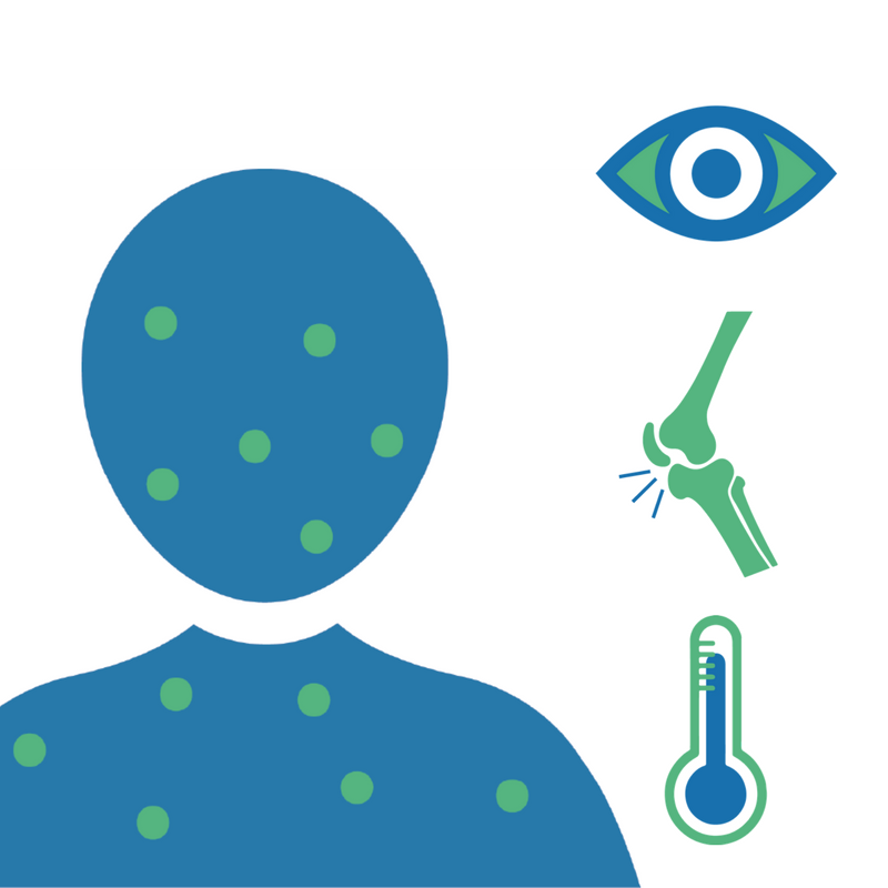 CentralMosquito's tweet photo. The symptoms of #Zika, including fever, joint pain, rash and red eyes, are similar to those of #dengue and #chikungunya. #MosquitoCentral https://t.co/zxXeXZhT0b