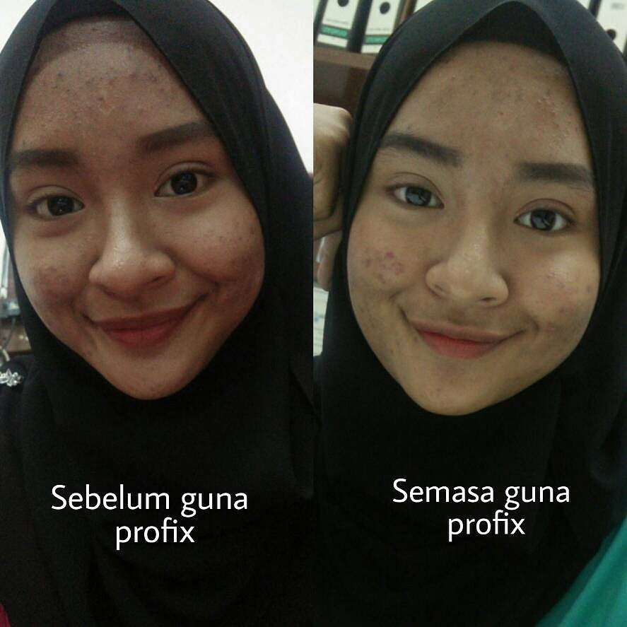 profixofficial's tweet photo. #Profix sesuai untuk lelaki dan wanita 😍.
.
for postage (harga promo) - order di bio 👆🏻 https://t.co/625xjsEVI8