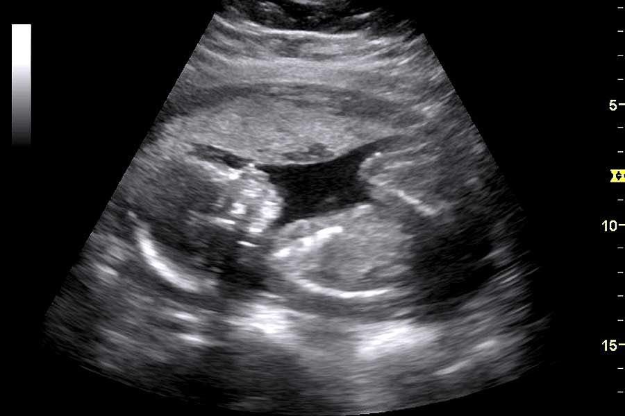 TheMrs_Proctor's tweet photo. My beautiful baby Johnathan Jr.  Only wish I would be around to see him grow but I will be hanged after his birth because of Abigail. https://t.co/DfMSX1BqAo