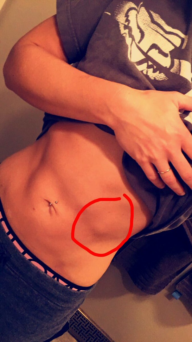 menkyoAFroelich's tweet photo. Anyone wanta guess? Cause I have no clue. Feels like my rib is jabbing my muscle - don't worry it's not stopping me. #mmaProblems https://t.co/KbAwkGwUwB