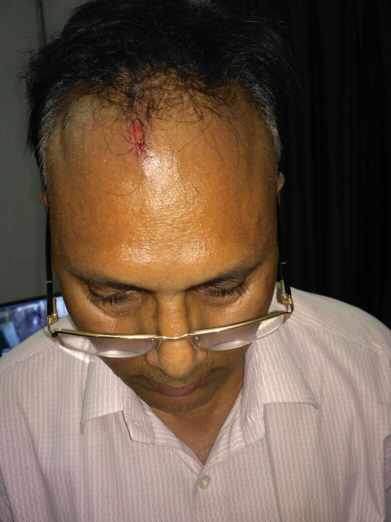JpuppclEr's tweet photo. मा ऊर्जा मन्त्री जी/अध्यक्ष,उप्रपाकालि विशेष ध्यानाकर्षण की अपेक्षा में,
   राजस्व वसूली के दौरान SDO/JE/ लॉइनमैन पर हुए प्राणघाती हमला। https://t.co/dSoufBF5JA