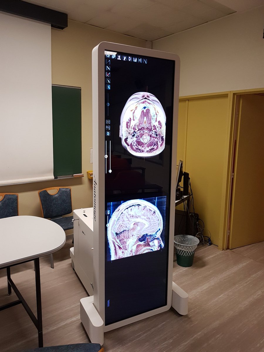 FB_nsgy's tweet photo. Neuroanatomical course using dissection anatomical table: a new pedagogical experience! #anatomage@chu_angers @Harvey_Cushing2 @yannbubien https://t.co/4JbtdJcug8