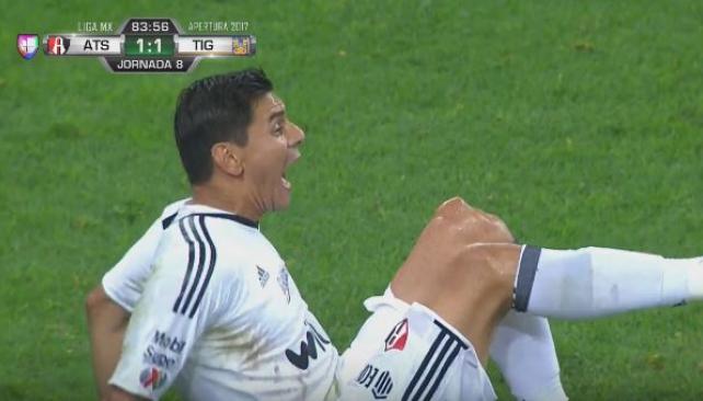 SoccerNewsEC's tweet photo. #LigaBancomerMx 
#Mexico 
Terrible lesión
#Argentina Oscar Ustari portero del @atlasfc se lesionó su rodilla izquierda
Fuerzas @23Osky ⚽ https://t.co/pIfkArOQCc