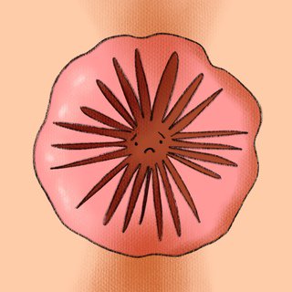 Pooper problems! 😨 Review common #anorectal disorders, physical exam findings, treatment &amp; complications: hippoed.com/urgentcare/rap… #MedEd