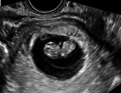 AgapeDSM's tweet photo. In 2016, Agape did 362 free ultrasounds! We will let you know soon how any we did in 2017! https://t.co/pN7vrCyxl8