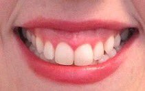 BleachMimosas's tweet photo. Do not speak to me if your mouth looks like this https://t.co/4xFeJCOe1v