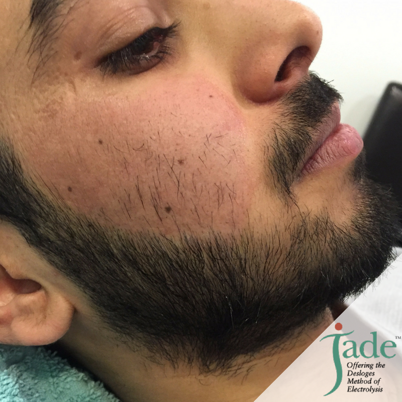 Jade Clinics on Twitter: Jade Clinics on Twitter: