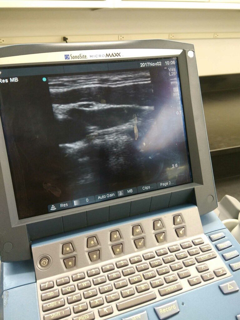 BCA_LHS's tweet photo. More from UCLA Sim Lab #thecvway @theCVway https://t.co/8XoZN3b7nV