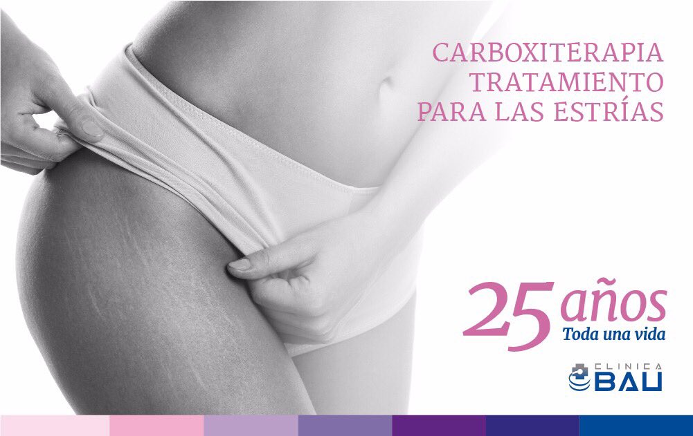 CARBOXITERAPIA
Surge como una alternativa médica con resultados extraordinarios, logrando atenuar las estrías en un porcentaje verdaderamente alto.
Infórmate en #ClínicaBau, la primera cita informativa es totalmente gratuita.
#25añosTodaunavida #CórdobaEsp