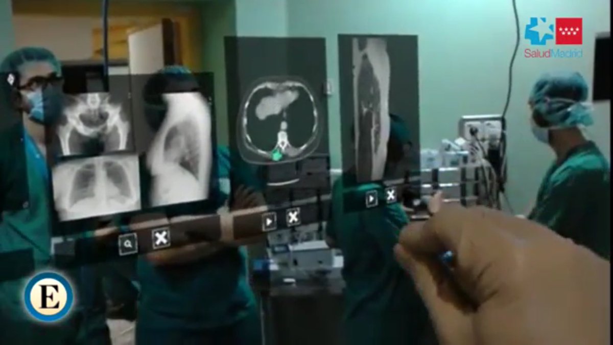 jsalinaswork's tweet photo. #HoloLens #AR
Operar un cáncer con ayuda de HoloLens es una realidad en Madrid https://t.co/Oc2UdrUMvn https://t.co/RAjX9rpNzH
