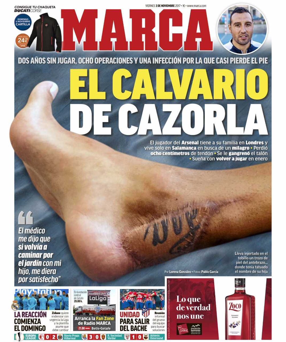 charles_watts's tweet photo. Santi’s Achilles. My God! Unbelievable. https://t.co/s1pQ0medxe