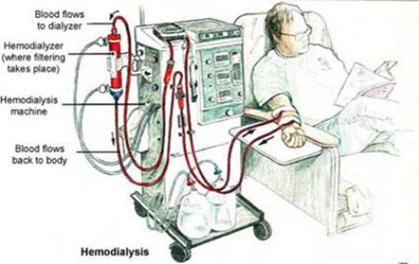 Uremia patients must dialysis for life?
Leave me a message, give you more professional guidance. Or send to my email: yuyingbeibei@gmail.com
