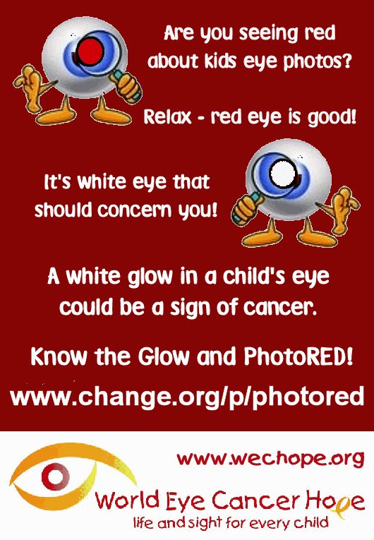 wechope's tweet photo. #RedEyes are not evil, they show healthy #retina! #KnowTheGlow & #PhotoRED to check for early signs of #ChildEyeCancer. Save life & sight! https://t.co/5z7nLayV3U