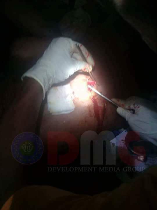 A Rakhine man left severely injured when a group of knife-wielding Bengali Muslims attacked Rakhine BuddhistsThursday, Nov 2, 2017
#Rakhine
