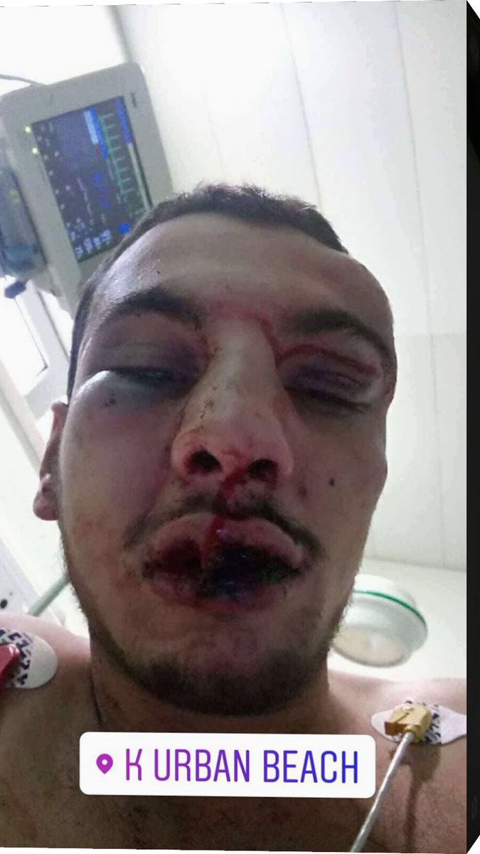 prazer_baiao's tweet photo. Resultado do sócio que levou porrada no Urban https://t.co/VSuTj0BqUs