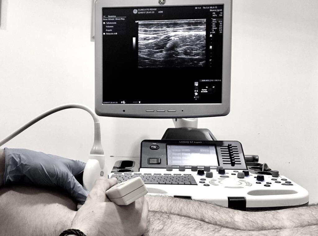 Ultima edición del 2017 en Elche!!#NMP #neuromodulacionpercutanea #formacionavanzadayacreditada #12edicion con <a href="/ValdesusoNMP/">Raúl Valdesuso</a> <a href="/inbiotem/">inbiotem</a>