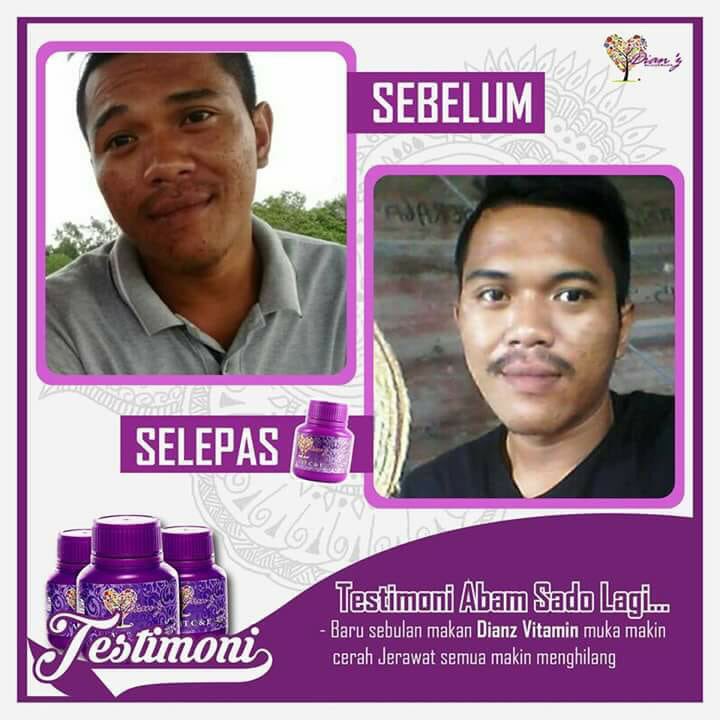 dianz_vit's tweet photo. Igt gegirl je td nak lawakan kulit, boboi pun sama! 😜 bukan cerah je, jerawat &amp; parut hilang weh 😍
📱 : https://t.co/xusRK0abCd https://t.co/4v0F1Yb4If